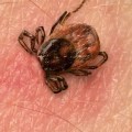 Diagnosing Common Insect-Borne Diseases